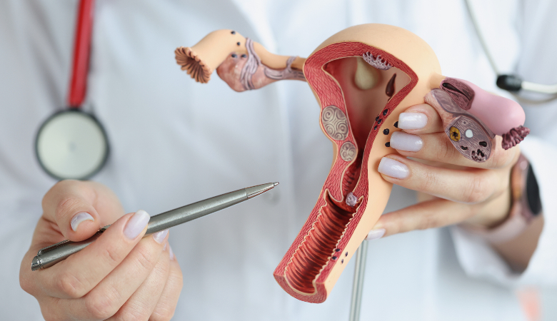 Por que pode ocorrer a secura vaginal durante a quimioterapia?