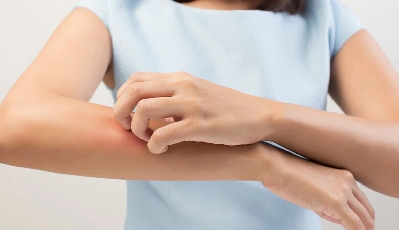 Tipos de alergias: tudo que você precisa saber sobre o assunto