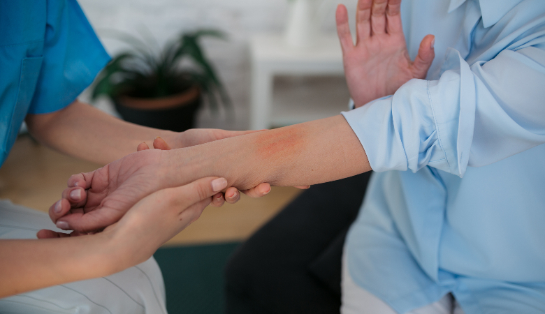 Descubra quais os tipos de eczema e aprenda a diferenciá-los