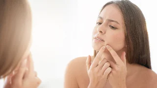Pele na adolescência: como o ginecologista pode ajudar?