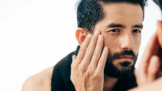 Melasma em homens: guia sobre causas, sintomas e tratamentos