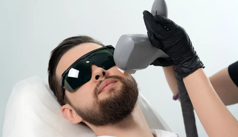 Melasma em homens: guia sobre causas, sintomas e tratamentos