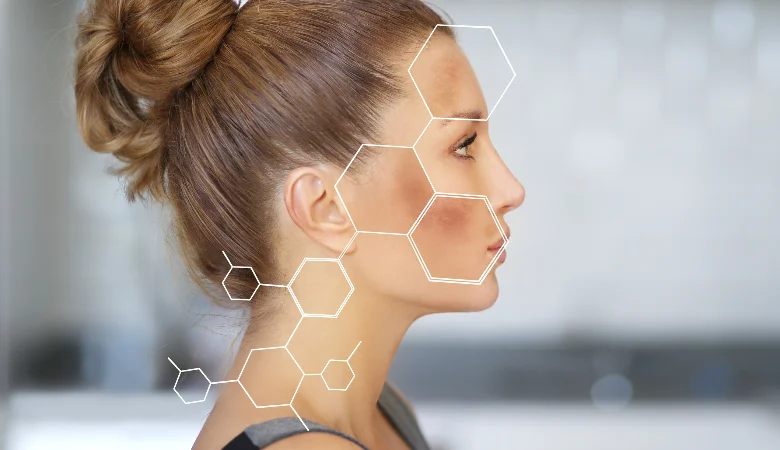 Vale a pena fazer clareamento facial? Descubra!