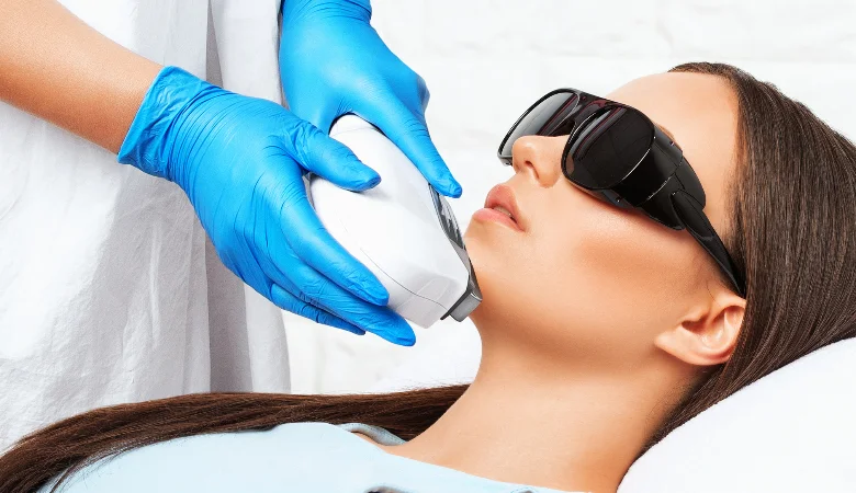 Melasma: O que é, quais os tipos e como tratar?