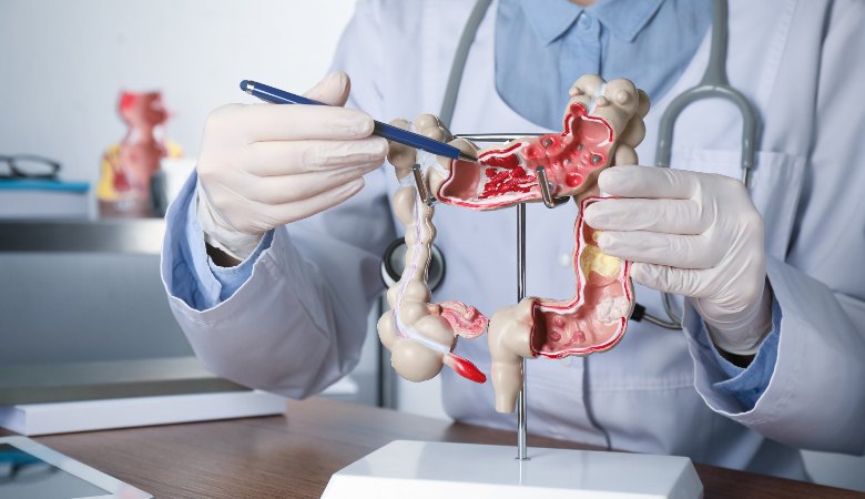 Problemas gastrointestinais: veja 5 relacionados à constipação intestinal!