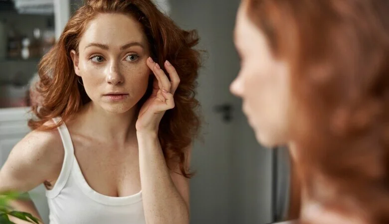 4 dicas que vão te ajudar a disfarçar melasma