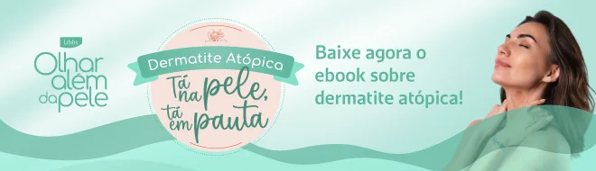 Dermatite atópica
