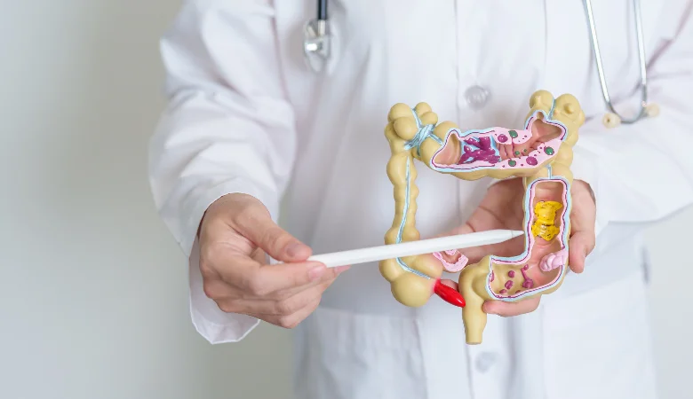Dores abdominais: confira um guia completo sobre diverticulite