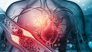 3 tipos de colesterol, suas funções e como prevenir doenças cardiovasculares!