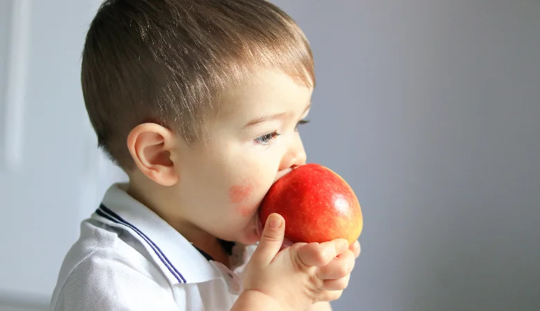 Alimentação e dermatite atópica: como a dieta ajuda ou atrapalha o tratamento?
