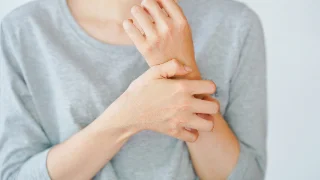 Alimentação e dermatite atópica: como a dieta ajuda ou atrapalha o tratamento?