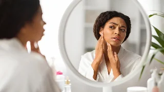 Efeitos colaterais no tratamento da acne: como lidar com eles?
