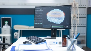 Epilepsia e convulsão: qual a diferença e como agir em uma crise?